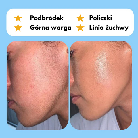 Epilator Vitalla